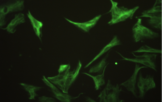 Primary Rat Thyroid Fibroblasts (TF)