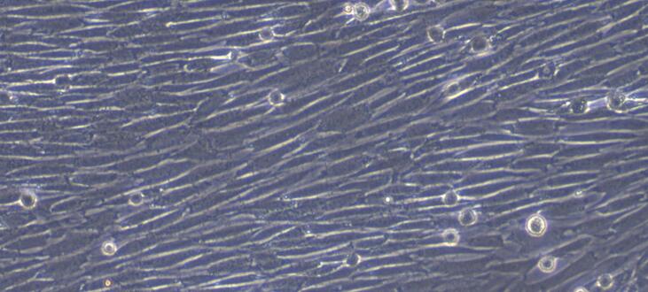 Primary Rabbit Thyroid Fibroblasts (TF)