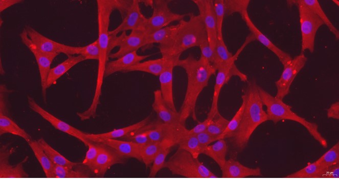 Primary Canine Uterine Smooth Muscle Cells (USMC)