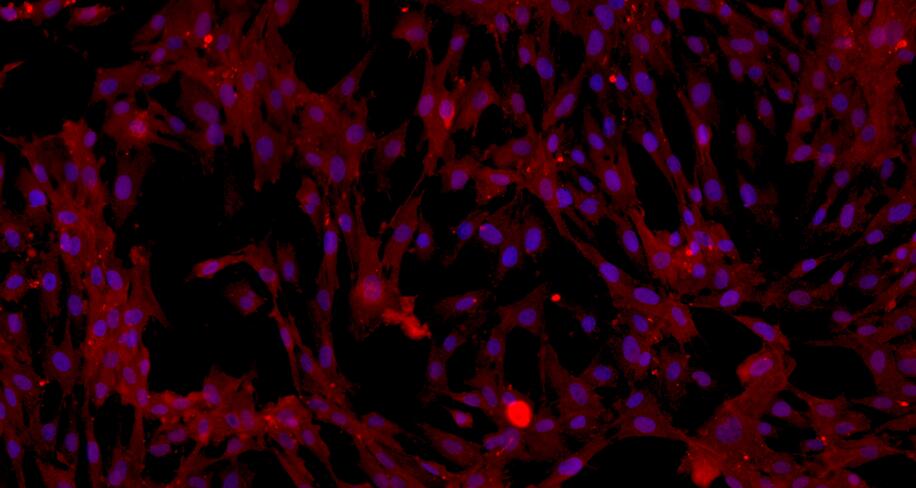 Primary Mouse Skeletal Muscle Cells (SkMC)