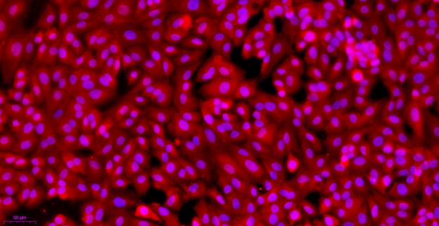 Primary Caprine Renal  Tubular Epithelial Cells (RTEC)