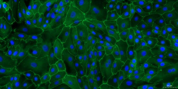 Primary Caprine Urethral Epithelial Cells (UrEC)