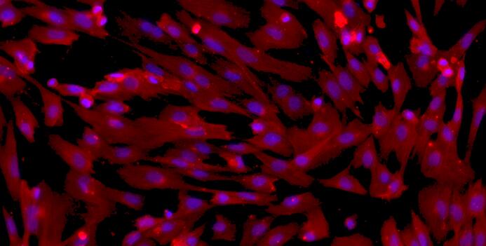 Primary Canine Bladder Smooth Muscle Cells (BSMC)