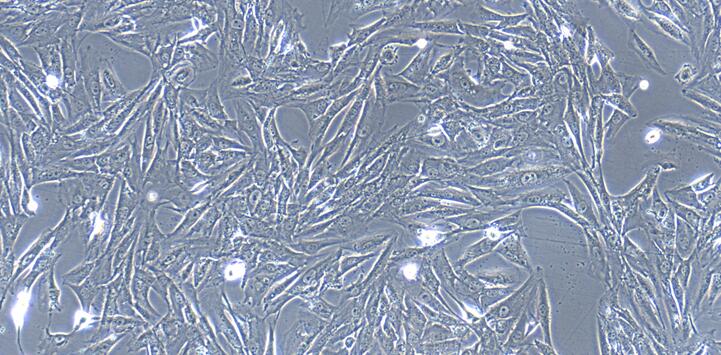 Primary Caprine Bladder Stromal Fibroblasts (BSF)