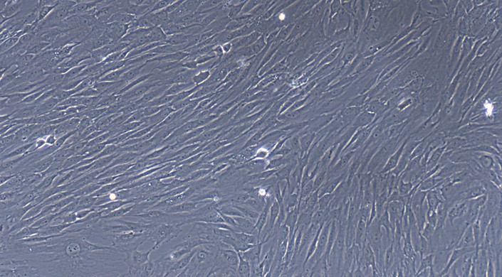 Primary Mouse Tracheal Smooth Muscle Cells (TSMC)