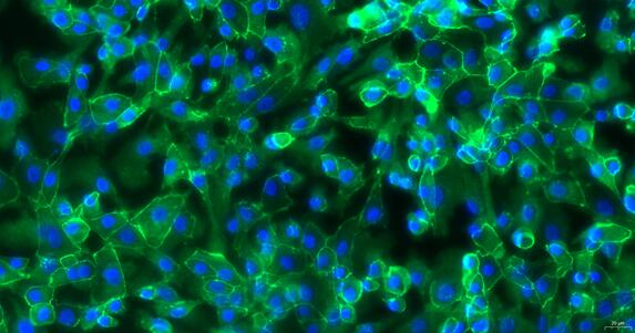 Primary Canine Tracheal Epithelial Cells (TEC)