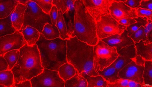 Primary Mouse Tracheal Epithelial Cells (TEC)