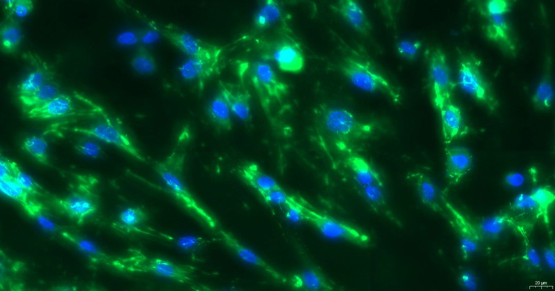 Primary Mouse Intestinal Fibroblasts (IF)
