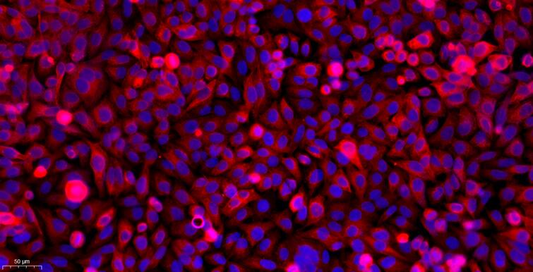 Primary Canine Neonatal Epidermal Keratinocytes (NEK)