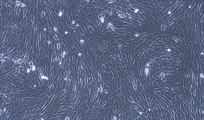 Primary Cavia Visceral Preadipocytes (VPA)