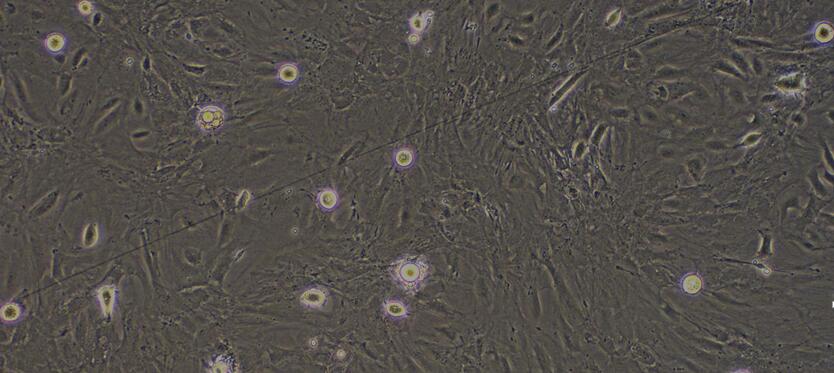 Primary Rat Visceral Preadipocytes (VPA)