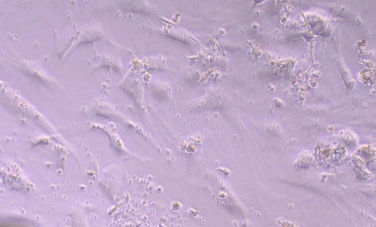 Primary Mouse Adult Dermal Fibroblasts (ADF)