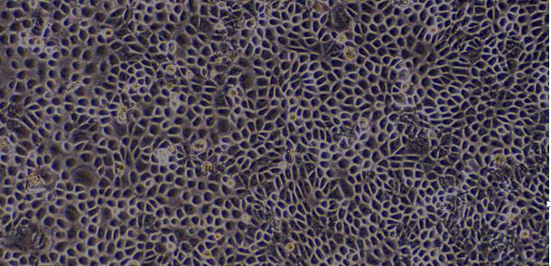 Primary Mouse Pulmonary Alveolar Epithelial Cells (PAEC)