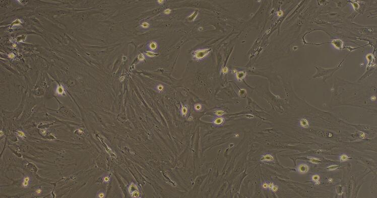 Primary Mouse Cardiac Fibroblasts (CF)