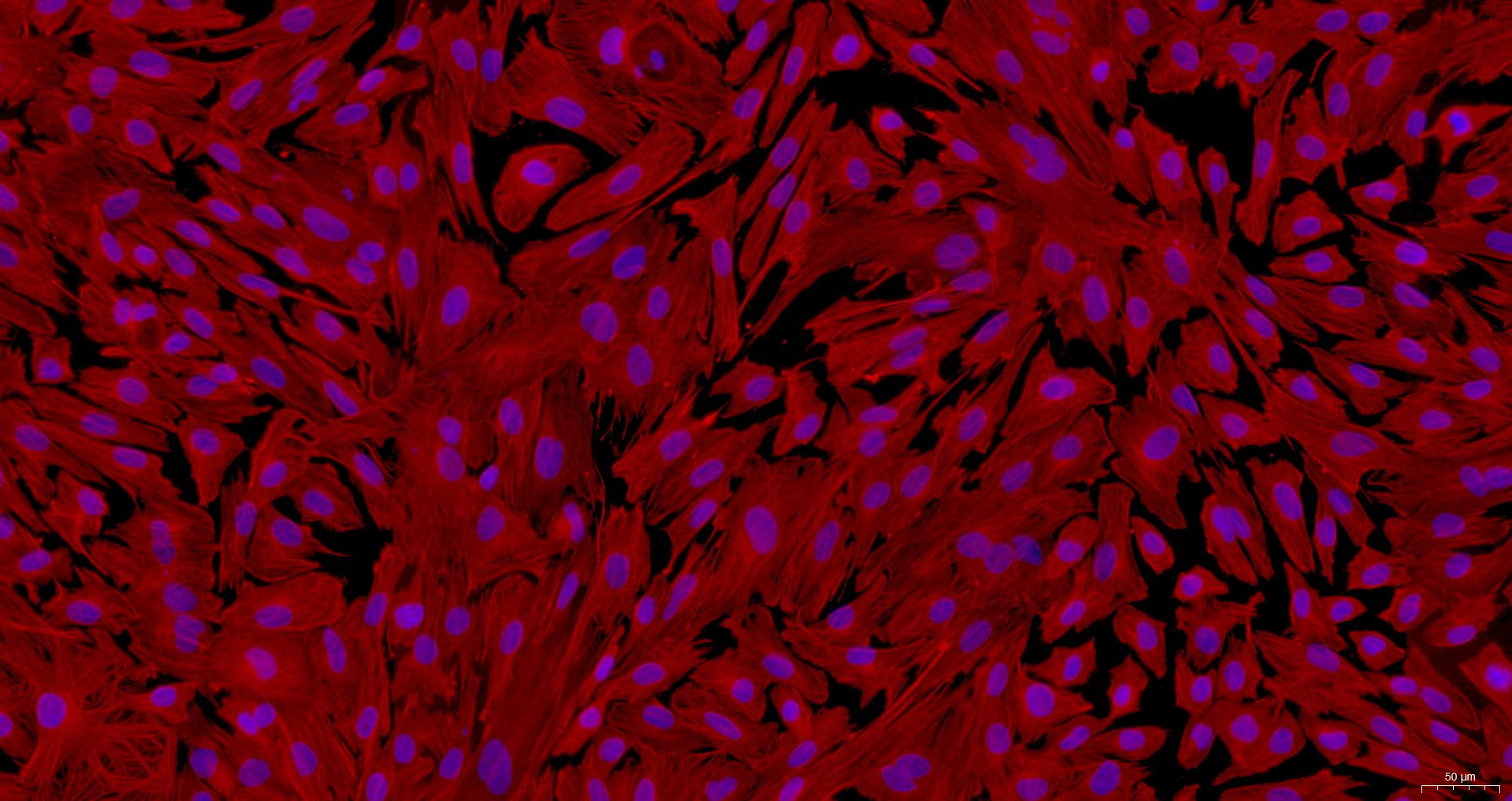 Primary Rabbit Cardiac Fibroblasts (CF)