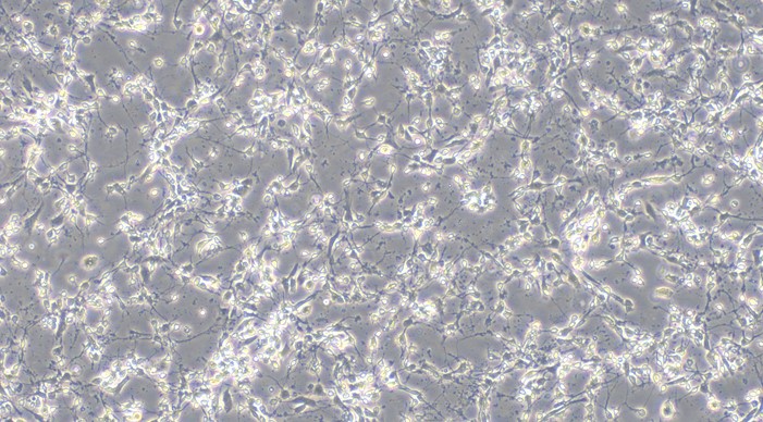 Primary Mouse Midbrain Neuron Cells (MNC)