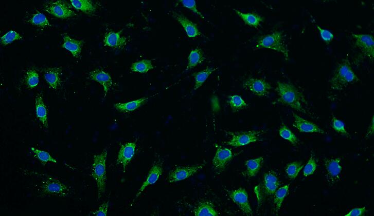 Primary Rat Osteoblasts (OB)