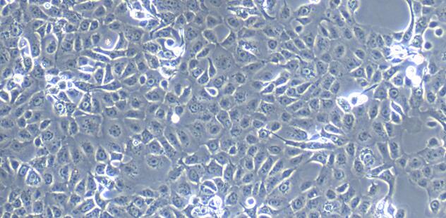 Primary Mouse Colonic Epithelial Cells (CEC)
