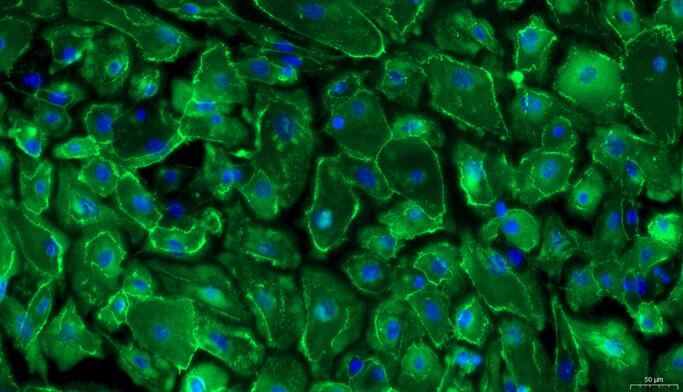 Primary Mouse Esophageal Epithelial Cells (EEC)