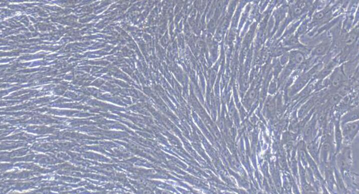 Primary Rabbit Gastric Smooth Muscle Cells (GSMC)