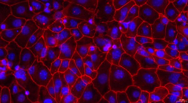 Primary Rat Cervical Epithelial Cells (CrEC)