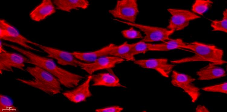 Primary Rabbit Synovial Cells (SYC)