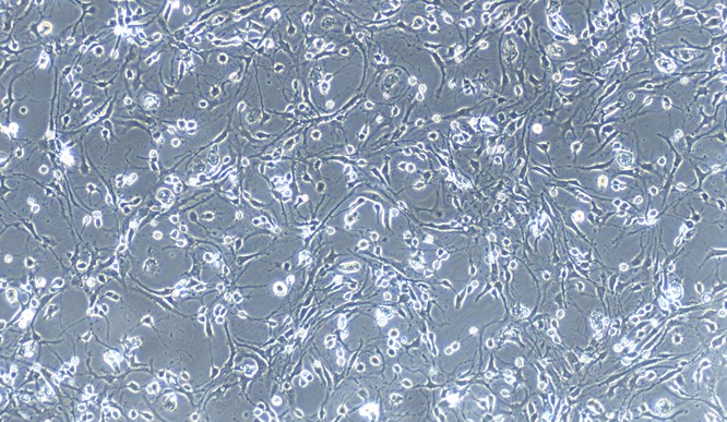 Primary Rat Cerebellar Granule Cells (CGC)