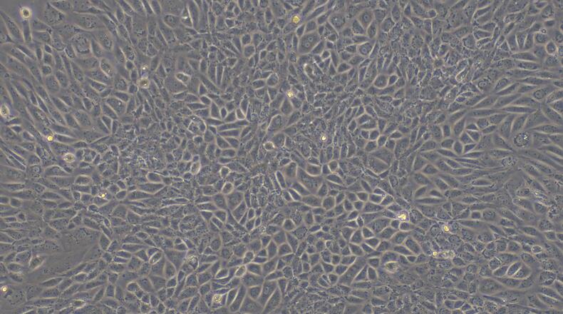 Primary Rat Hepatic Sinusoidal Endothelial Cells (HSEC)