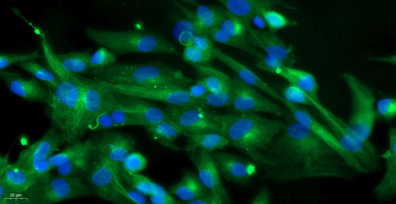 Primary Mouse Ovarian Fibroblasts (OF)