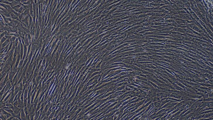 Primary Caprine Aortic Smooth Muscle Cells (ASMC)