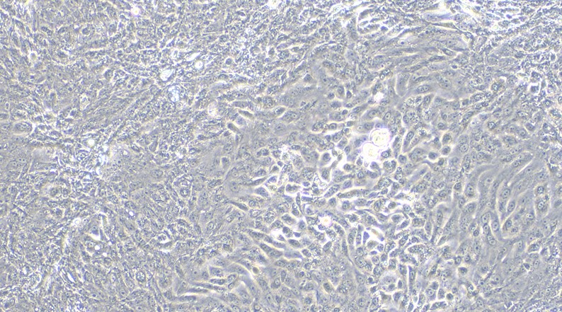 CSI160Ca01.jpg
