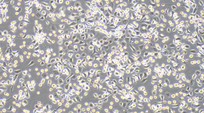 Primary Rabbit Hepatic Macrophages (HM)