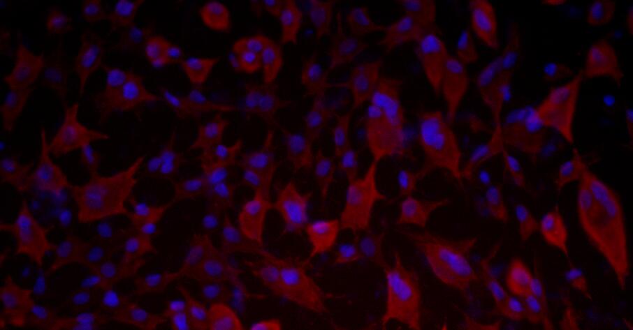 Primary Rat Bladder Epithelial Cells (BEC)