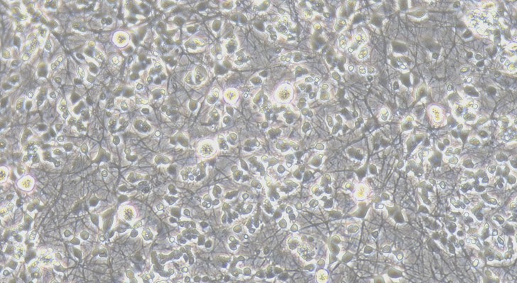 Primary Rat Retinal Ganglion Cells  (RGC)