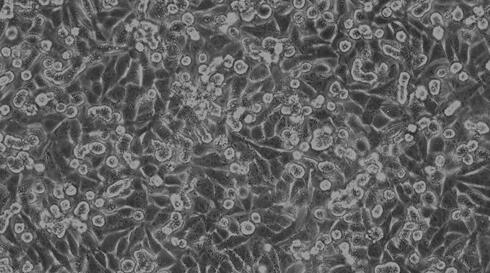Mouse B16 Melanoma Cells (B16)