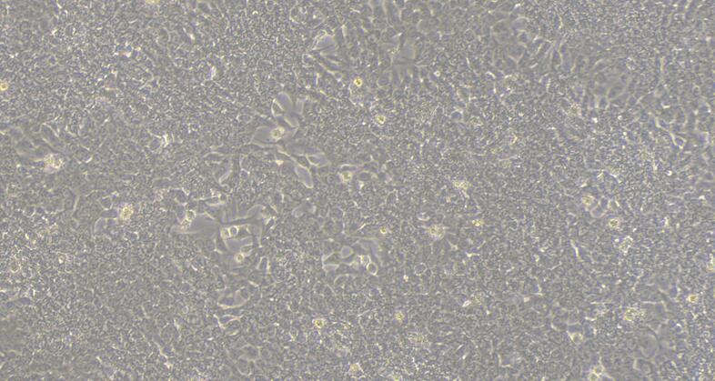 CSI204Hu11.jpg