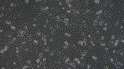 CSI208Hu11.jpg