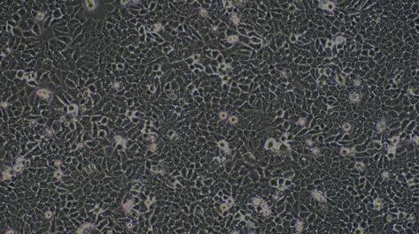 Human Bladder Carcinoma Cells (BCC)