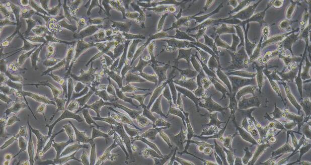 Mouse Embryonic Fibroblasts (EF)