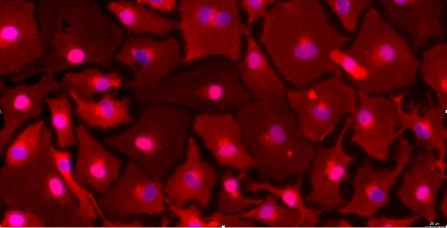 Primary Rabbit Peritoneal Mesothelial Cells (PMC)