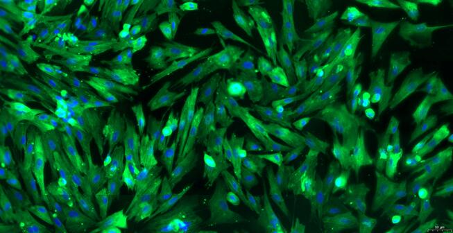 Primary Canine Ureteral Smooth Muscle Cells (USMC)