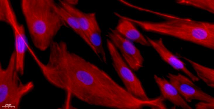 Primary Rabbit Corneal Stromal cells (CSC)