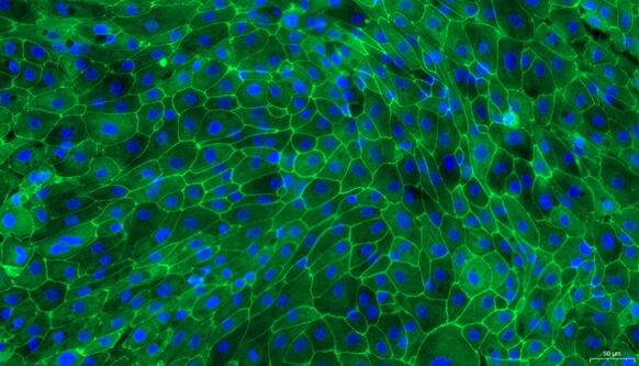 Primary Porcine Ureteral Epithelial Cells (UEC)