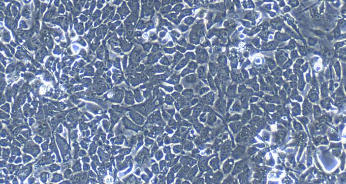 Primary Rabbit Ureteral Epithelial Cells (UEC)