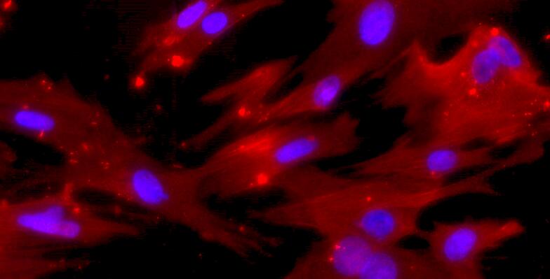 Primary Rabbit Small Airway Smooth Muscle Cells (SASMC)