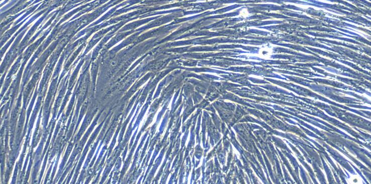 Primary Canine Pancreatic Fibroblasts (PNF)