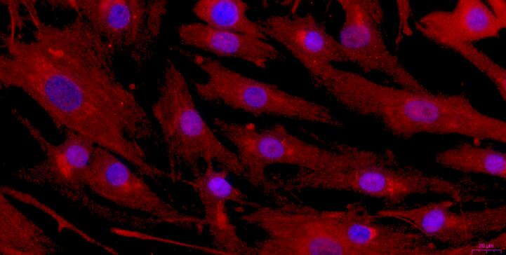 Primary Rabbit Urethral Smooth Muscle Cells (UrSMC)