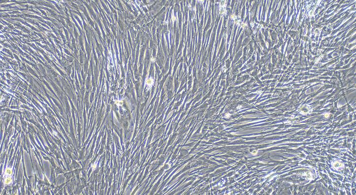 Primary Rabbit Vas Deferens Smooth Muscle Cells (VDSM)