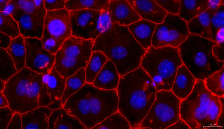 Primary Rabbit Vas Deferens Epithelial Cells (VDEC)