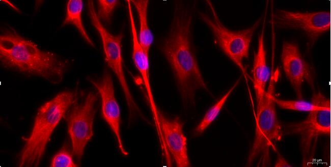 Primary Rat Femoral Artery Endothelial Cells (FAEC)